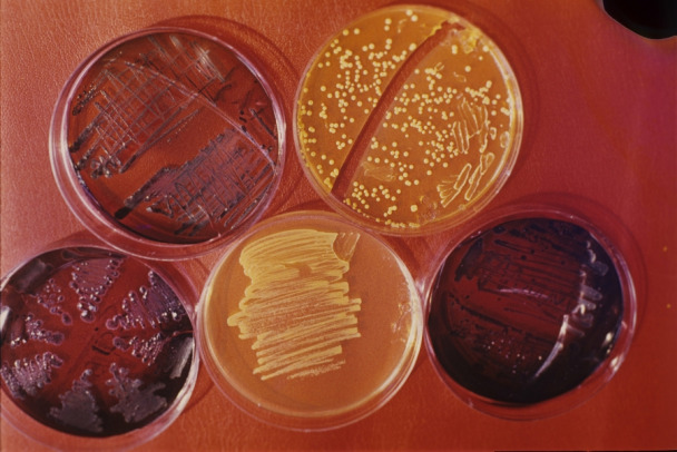 ВОЗ заявила, что бактерии стали устойчивее к антибиотикам