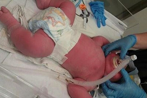 СК идет в роддом Петербурга за халатность. Младенец под особым присмотром родился инвалидом