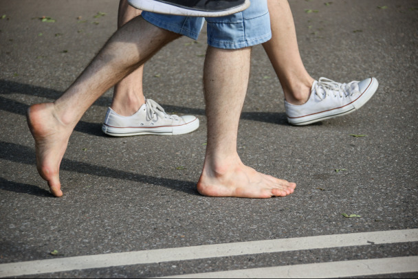 Хирург объяснил, как распознать деформацию стопы